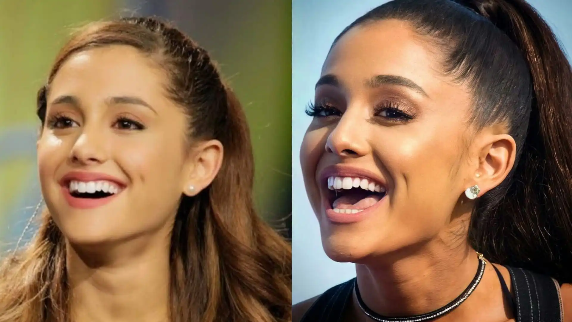 Ariana Grande teeth before after