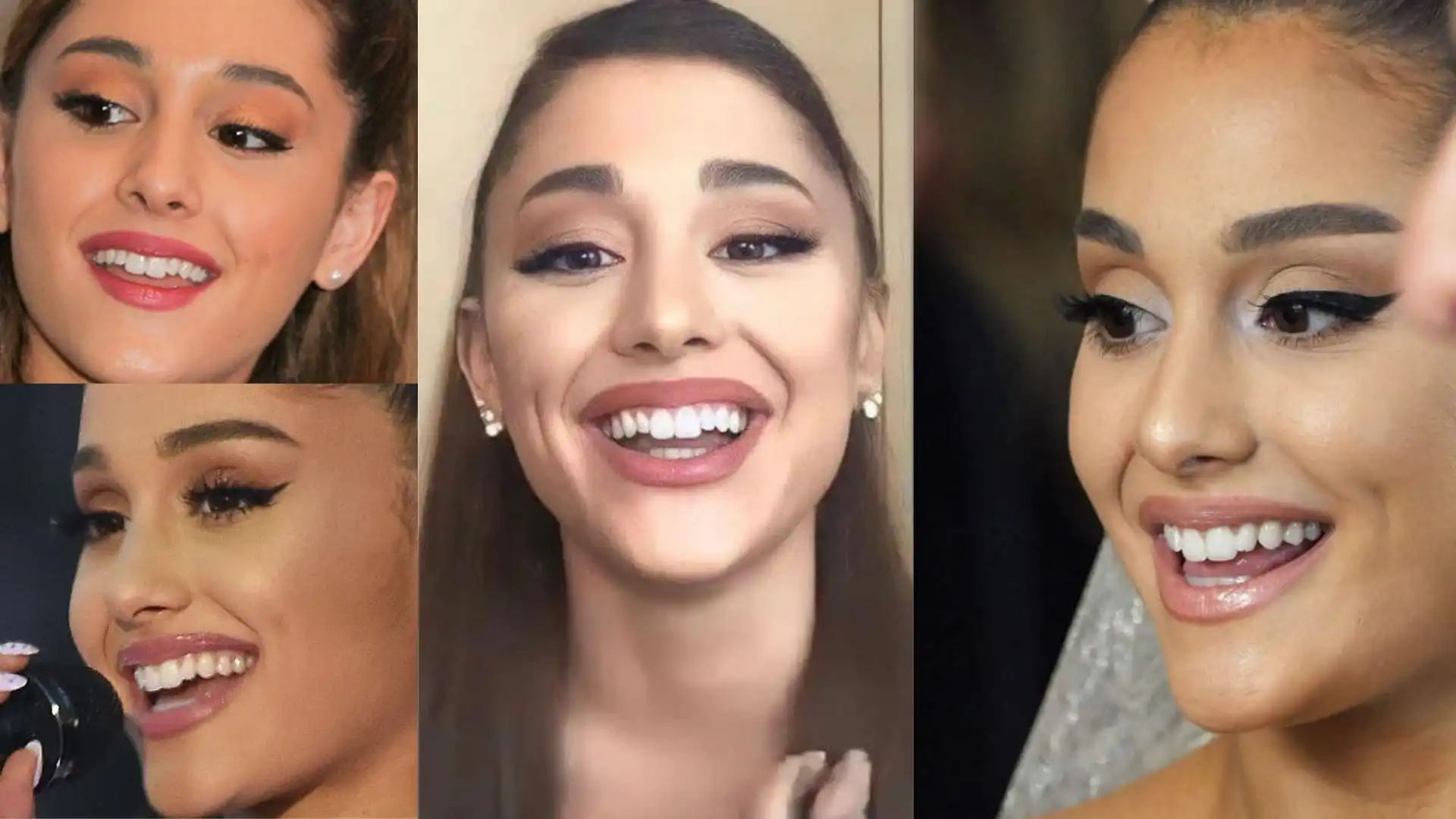 Ariana Grande teeth before after