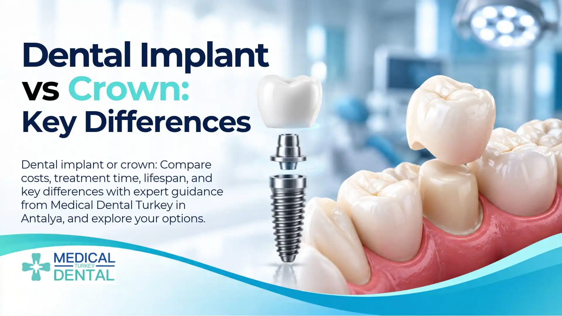 Dental Implant or Crown: Which Treatment Is Right for You? 