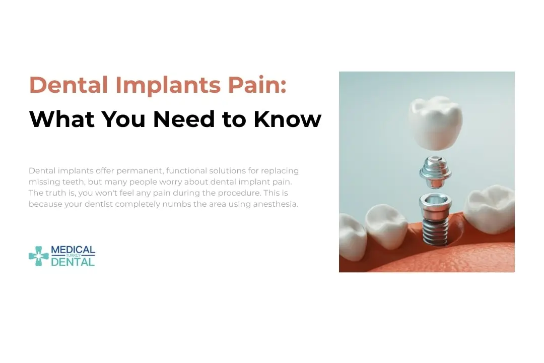 Dental implants pain