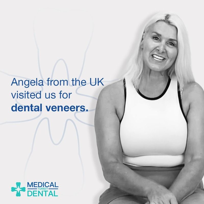 Angela from USA visited turkey and had  a dental veneers