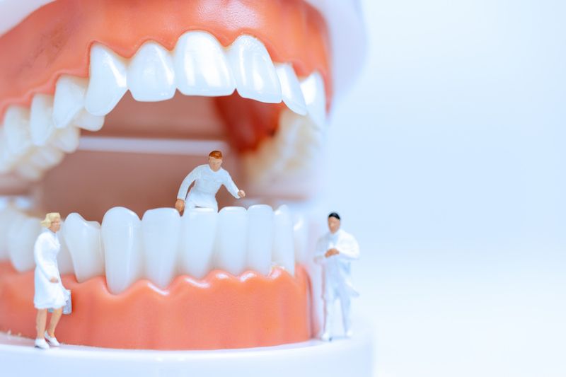 a teeth model in which doctors doing gum contouring operation
