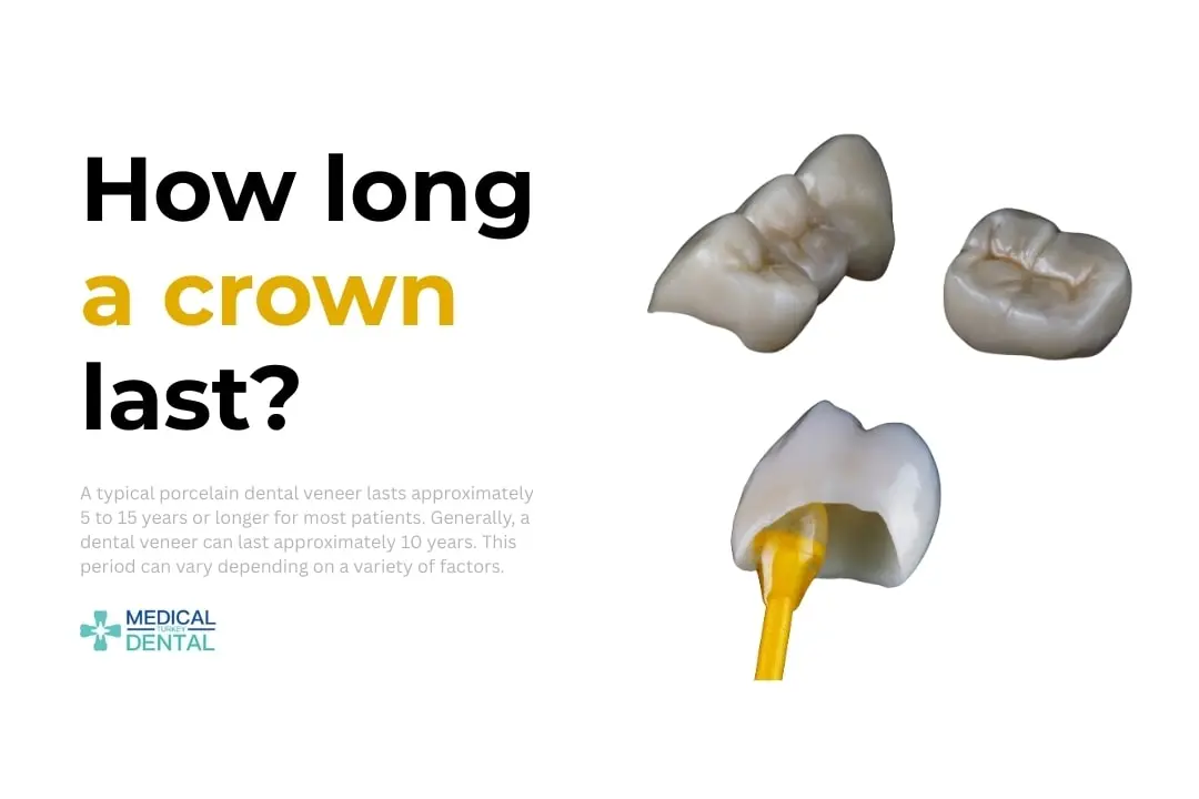 How long a tooh crown last?