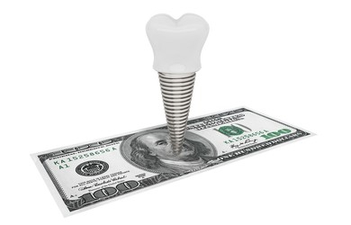 How Much Are Dental Implants Cost in Antalya Turkey?