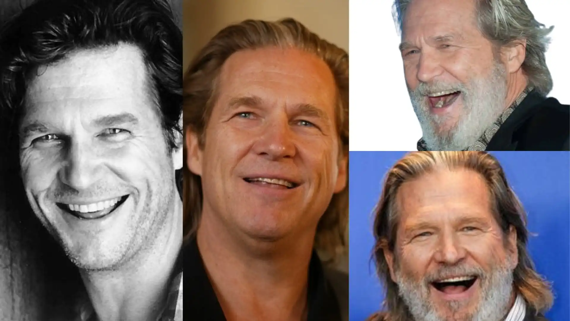 Jeff Bridges teeth before after