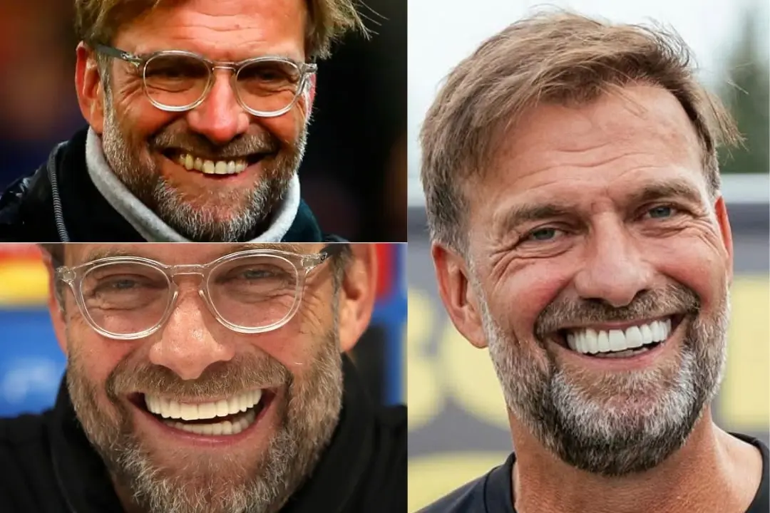 Jürgen Klopp teeth before after Jürgen Klopp teeth before after