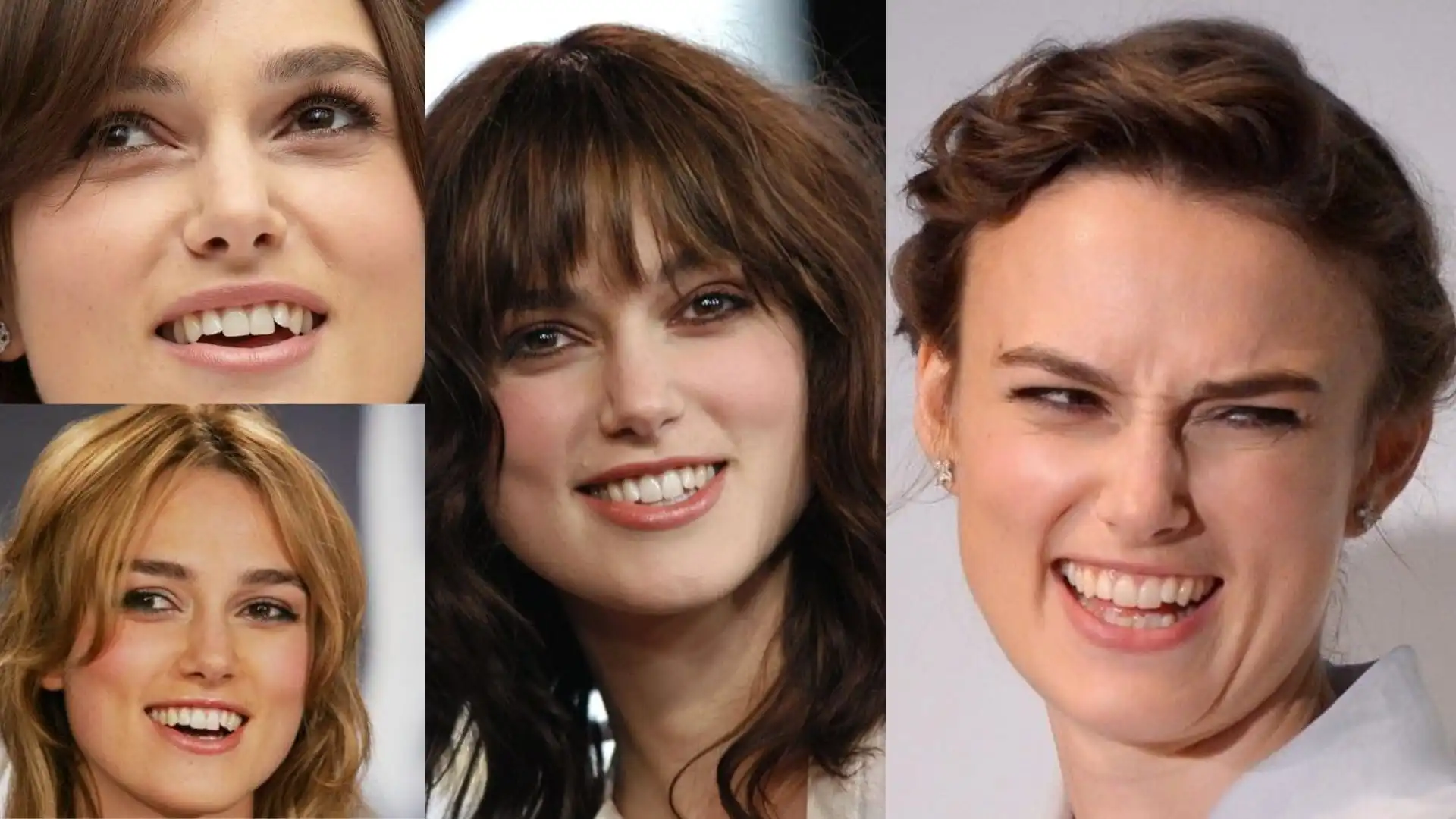 Keira Knightley teeth before after