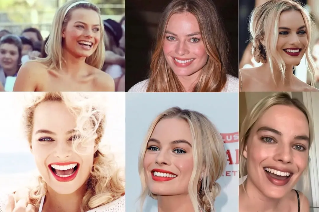 Margot Robbie teeth before after Margot Robbie with veneers before after
