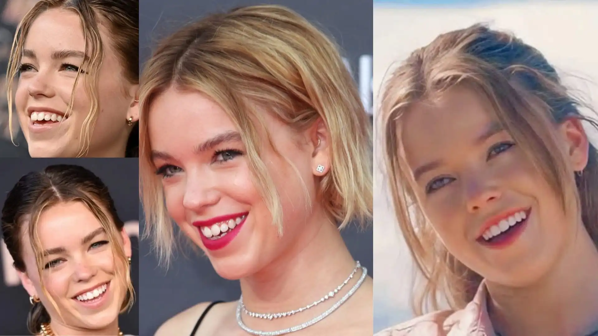 Milly Alcock teeth before after