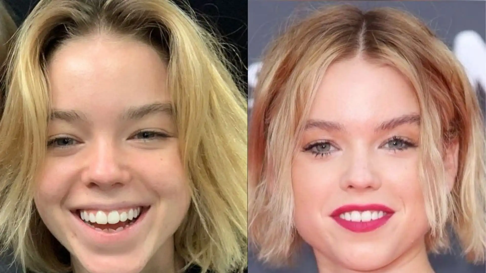 Milly Alcock teeth before after