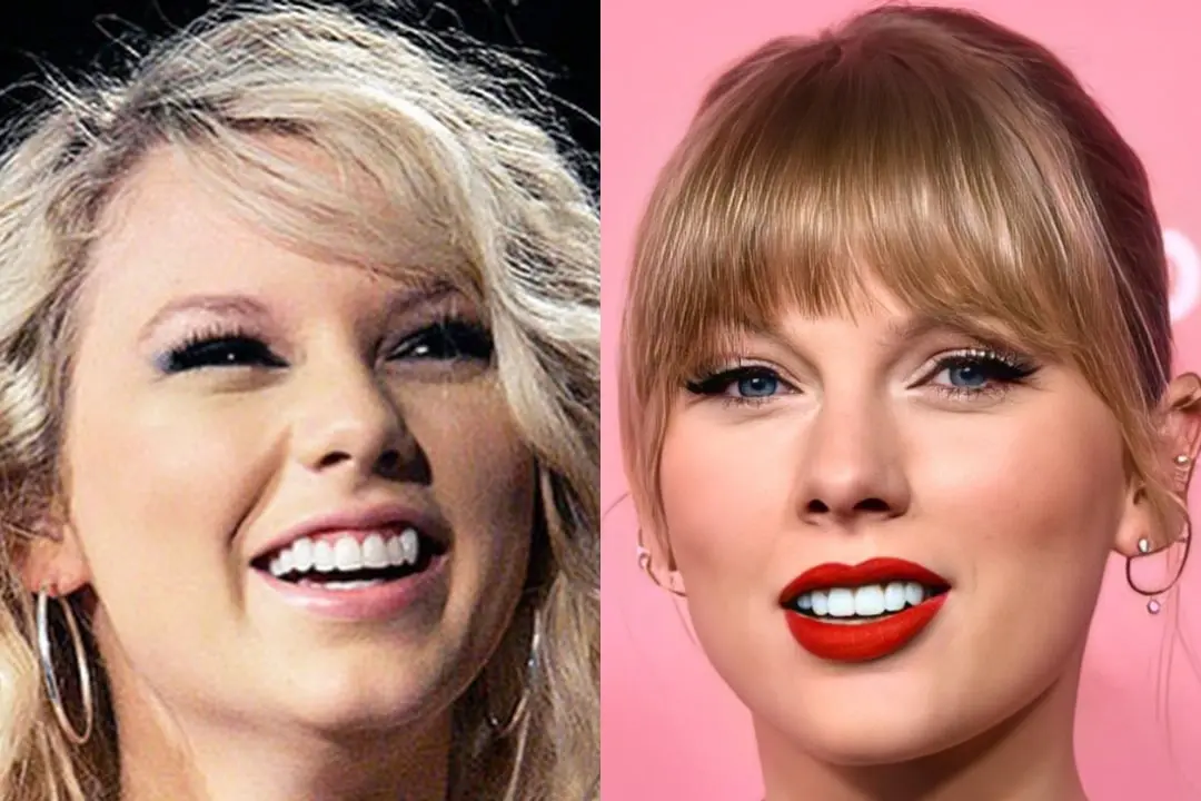 Taylor Swift teeth before after Taylor Swift teeth before after