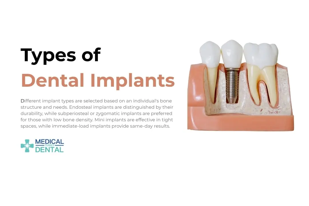 Types of Dental Implants