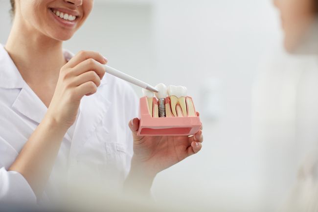 What Are The Possible Side Effects Of Dental Implants 2 