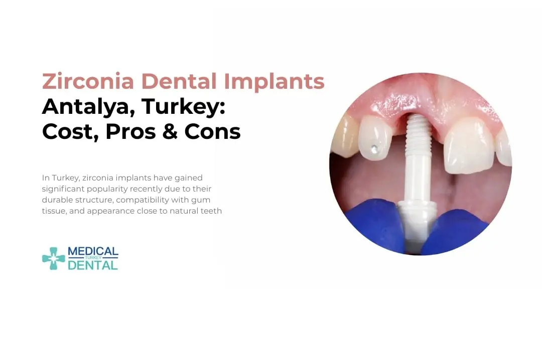 Zirconia dental implant Antalya, Turkey