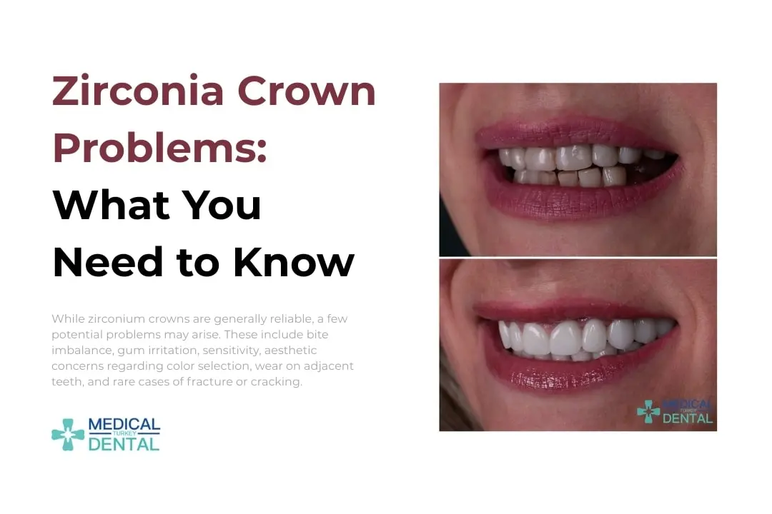 Zirconia crown problem in Antalya, Turkey